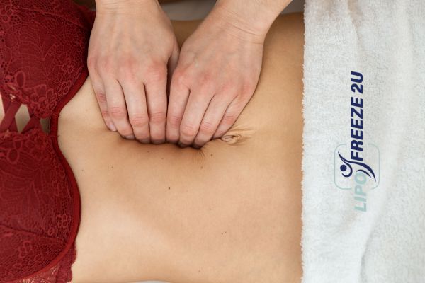 diastasis recti treatment Rickmansworth