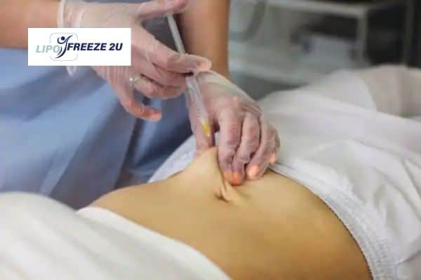 Fat Dissolving Injections Rickmansworth & Weight loss medication