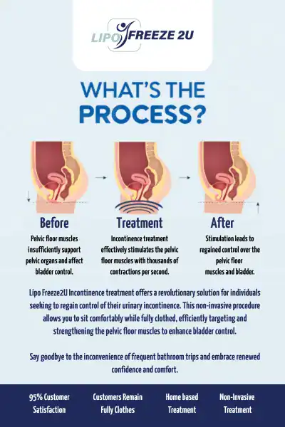 Diagram of how incontinence treatment Rickmansworth works.