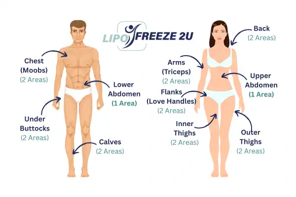 Areas you can have fat freezing treatment Rickmansworth
