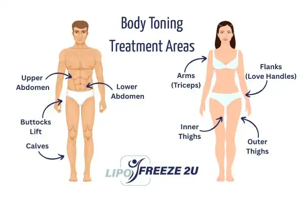 Graphic showing where you can have Body toning Treatment Rickmansworth on your body