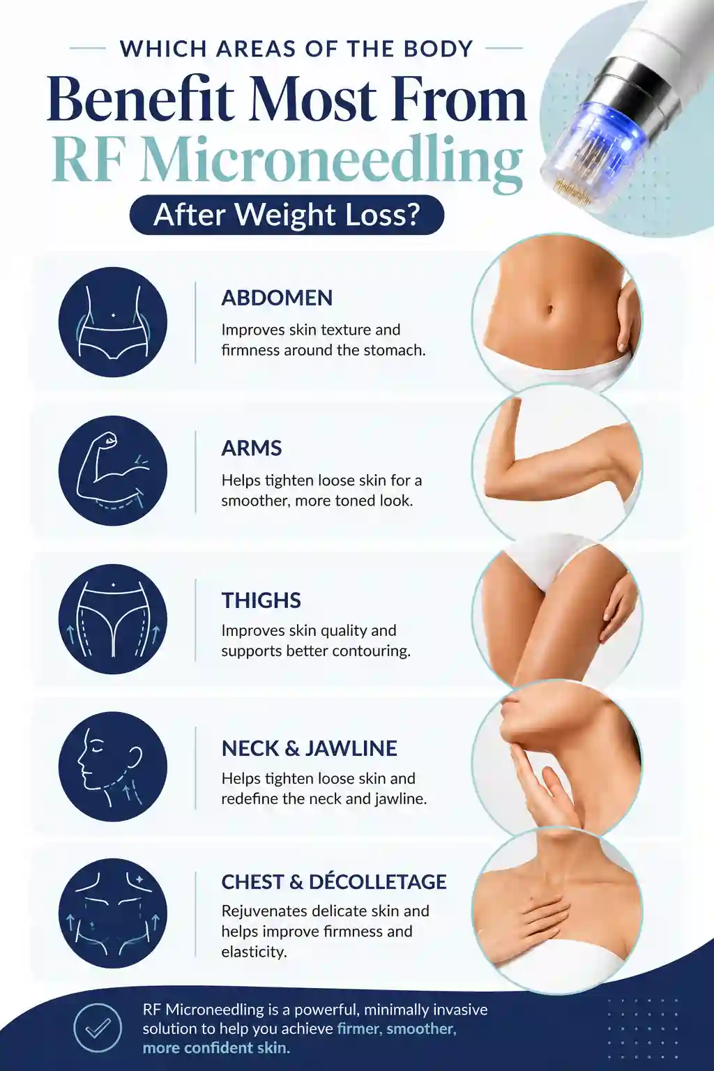 Which Areas of the Body Benefit Most From RF Microneedling After Weight Loss Rickmansworth